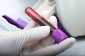 Est-il possible de faire une prise de sang sans ordonnance ?